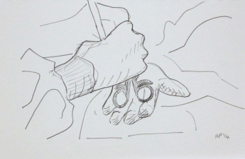 WRIST SURGERY | 14.8 x 21cms | Pen on Paper | 2014 | <a href="https://helenpurdie.co.uk/contact/">ENQUIRY</a>